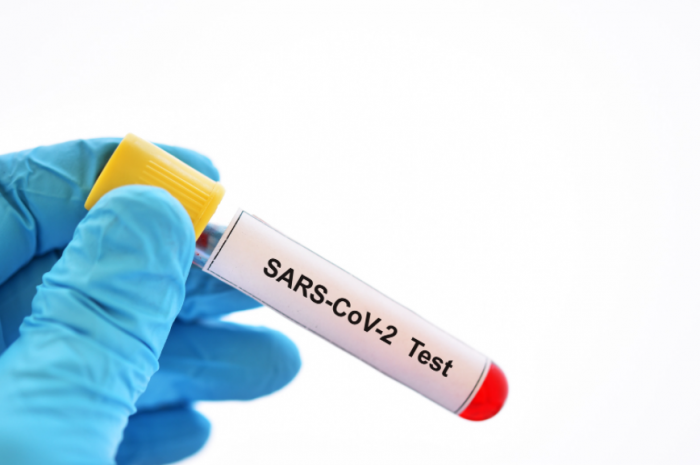 Không sử dụng xét nghiệm kháng thể SARS-CoV-2 sai mục đích