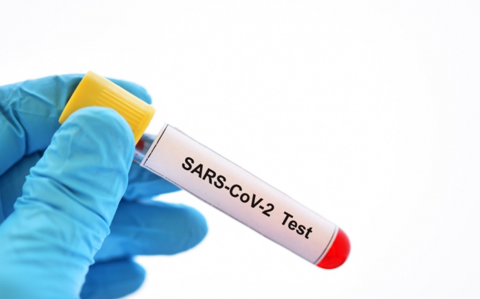 Xét nghiệm SARS-CoV-2 trong giai đoạn thích ứng an toàn