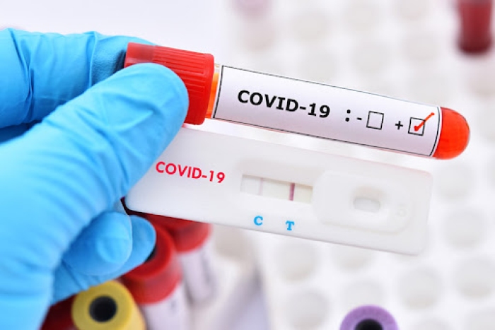 Cơ sở đủ điều kiện mua bán sinh phẩm xét nghiệm nhanh kháng nguyên virut SARS-CoV-2 trên địa bàn tỉnh
