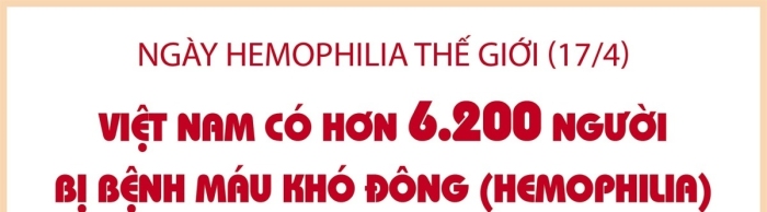 vna potal viet nam co hon 6200 nguoi bi benh mau kho dong hemophilia (1)