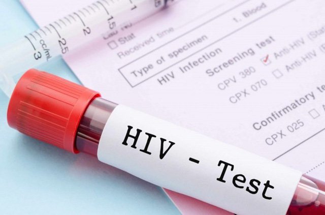 Khuyến cáo phương cách xét nghiệm chẩn đoán HIV quốc gia bổ sung năm 2020 (có  file văn bản kèm theo).